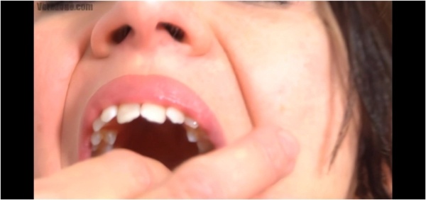 Gtszone  - Vorezone 278 Betty