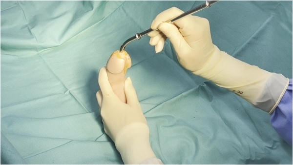 Aria Nicole - Extreme Urethral Stretching With Finger