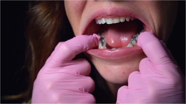 Destines Dungeon - 10 Minute Silver Fillings